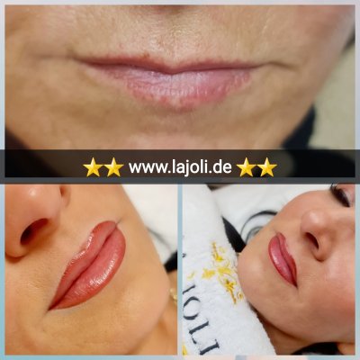 Lippen Permanent Make Up Bilder - LAJOLI Hamburg Lips - Lippen aufspritzen