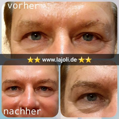 Augenbrauen Permanent Make Up Männer Bilder 102 - LAJOLI Hamburg -  eyebrows
