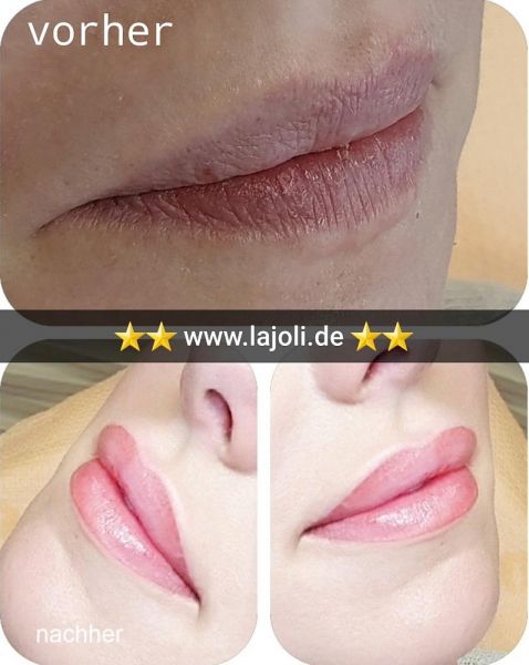 Lippen Permanent Make-Up Bilder von LAJOLI Profi Manuela Leja aus Hamburg - Lips - Bilder Galerie und Lippen aufspritzen mit Hyaluronsäure - Lips - Bilder Galerie
