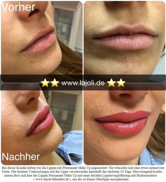 LAJOLI Lippen Permanent Make-Up kombiniert mit Lippen aufspritzen mit Hyaluronsäure - Hamburg