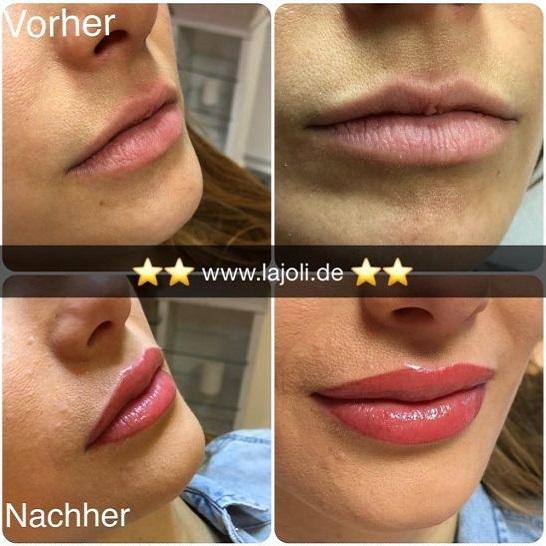 Lippen Permanent Make Up Bilder - LAJOLI  Manuela Leja lips - Hamburg