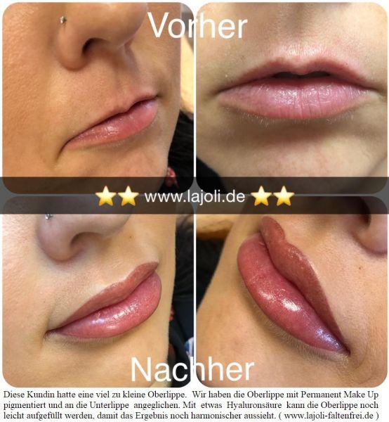 LAJOLI Lippen Permanent Make-Up und Lippen aufspritzen mit Hyaluronsäure - Hamburg
