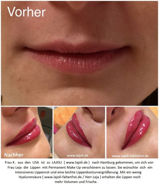 LAJOLI Lippen Permanent Make Up Bilder von Manuela Leja und Lippen aufspritzen mit Hyaluronsäure - Kundin aus den USA 