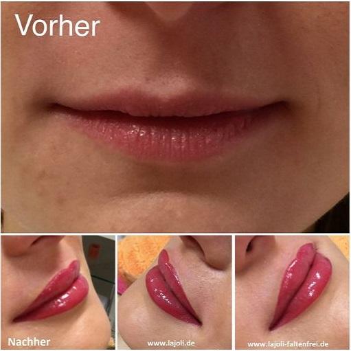 LAJOLI Lippen Permanent Make Up Bilder - Manuela Leja lips - Hamburg - Lippen aufspritzen