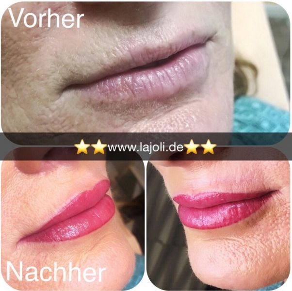 LAJOLI Lippen Permanent Make-Up von Profi Frau Leja und Lippen aufspritzen mit Hyaluronsäure - Hamburg
