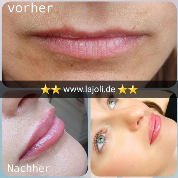 LAJOLI Lippen Permanent Make-Up von Profi Frau Leja und Lippen aufspritzen mit Hyaluronsäure - Lips Hamburg