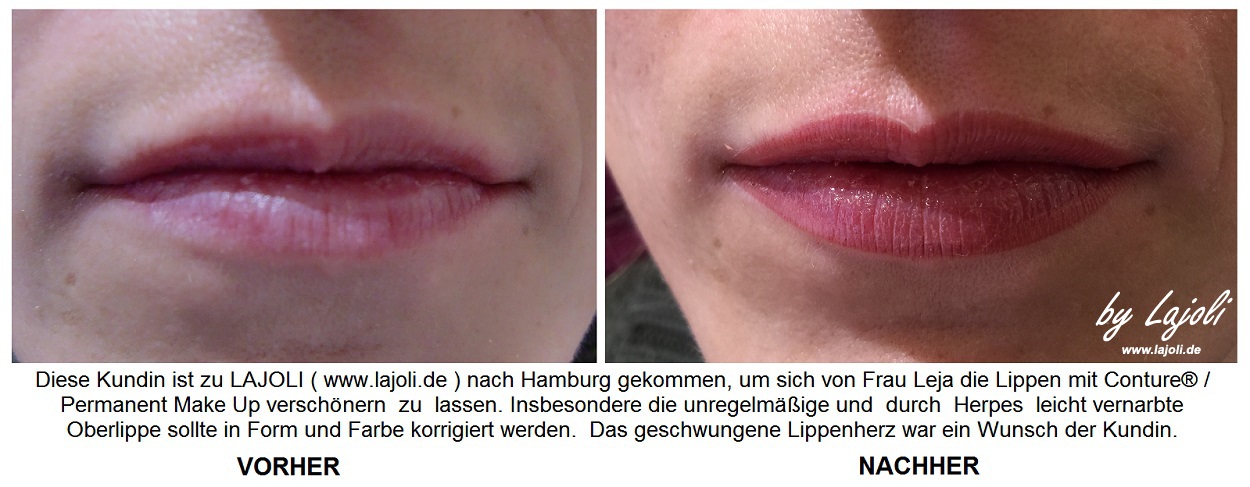 LAJOLI Permanent Make Up Hamburg - Lippenkorrektur - Faltenunterspritzung / Fadenlifting