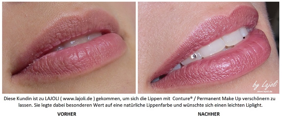 LAJOLI Permanent Make Up / Kosmetik Hamburg - Faltenunterspritzung / Fadenlifting - Lippen aufspritzen - Kundin aus Kiel