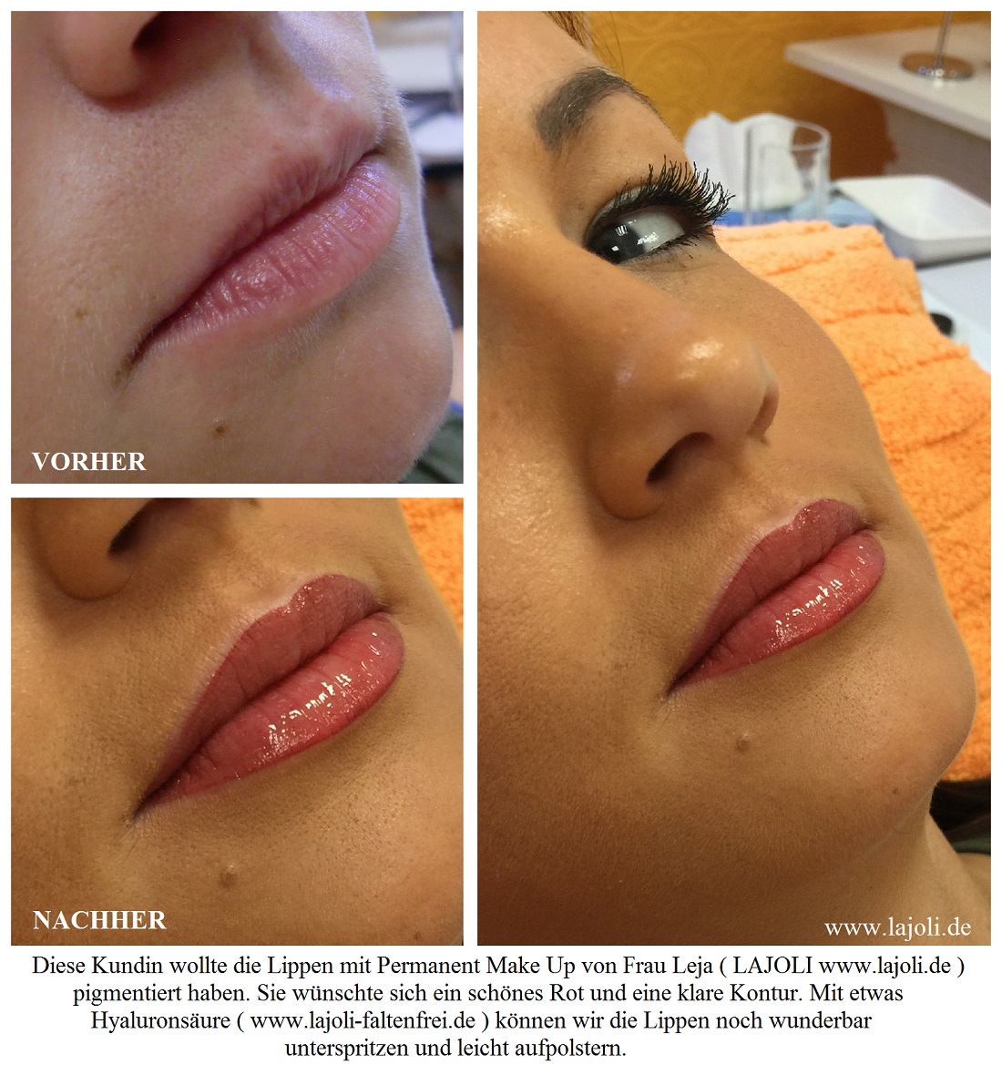 LAJOLI Lippen Permanent Make Up / Kosmetik Hamburg - Lippen aufspritzen - Faltenunterspritzung