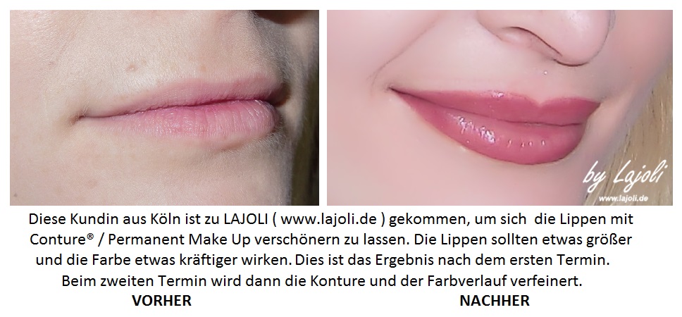 LAJOLI Permanent Make Up / Kosmetik Hamburg - Faltenunterspritzung / Fadenlifting - Lippen aufspritzen - Kundin aus Köln