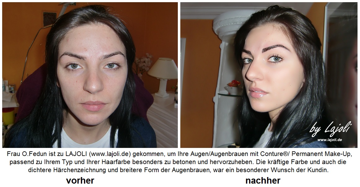 LAJOLI Permanent Make-Up / Kosmetik Hamburg Faltenunterspritzung - www.lajoli.de