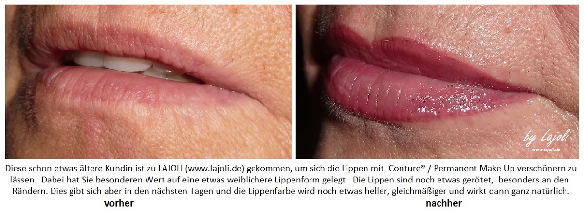 LAJOLI Permanent Make Up / Kosmetik Hamburg - Faltenunterspritzung / Fadenlifting - Lippen aufspritzen