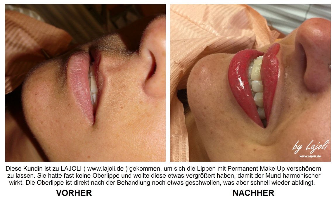 LAJOLI Lippen Permanent Make Up Bilder aus Hamburg - Lippen aufspritzen und Faltenunterspritzung