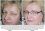 LAJOLI Permanent Make-Up Bilder Augenbrauen - Frau S. aus Büsum