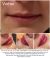 LAJOLI Bilder Lippen Permanent Make Up & Lippen aufspritzen mit Hyaluronsäure